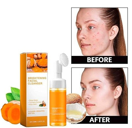 Turmeric Brightening Face Wash – Deep Cleansing & Natural Glow (150ml)
